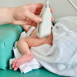 Ultrazvukové vyšetření kyčlí u dětí